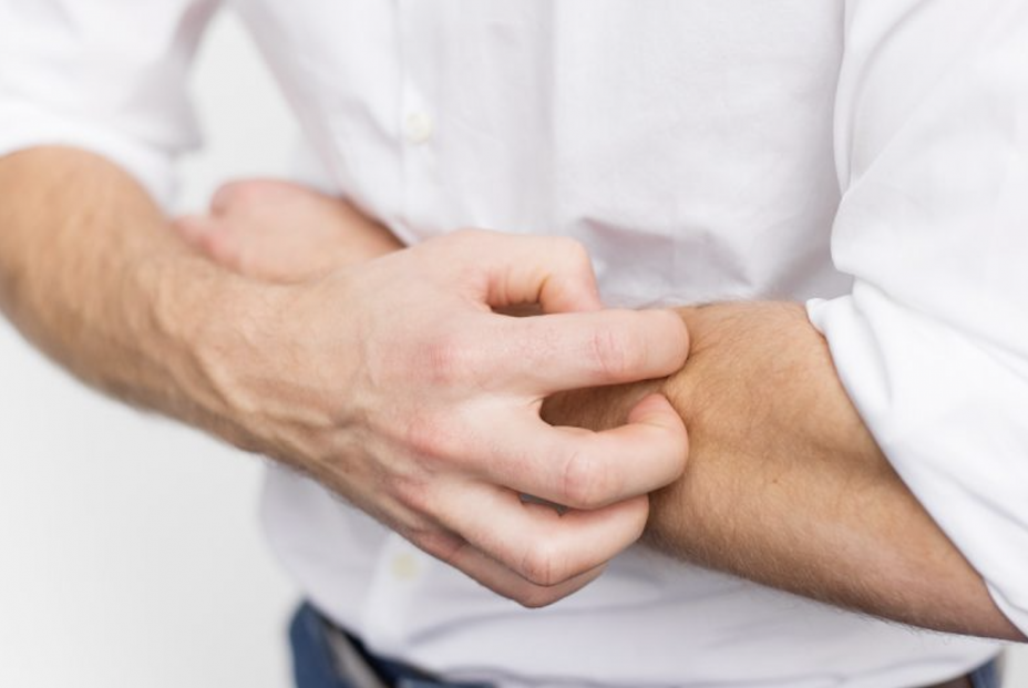 Descubiertos cinco grandes tipos de lesiones cutáneas en pacientes con coronavirus Descubiertos cinco grandes tipos de lesiones cutáneas en pacientes con coronavirus