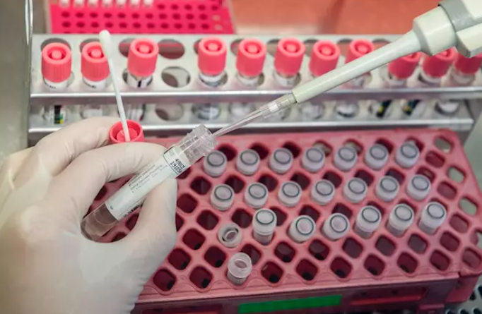 Estudios sobre el Covid-19. Foto: Europa Press Estudios sobre el Covid-19. Foto: Europa Press