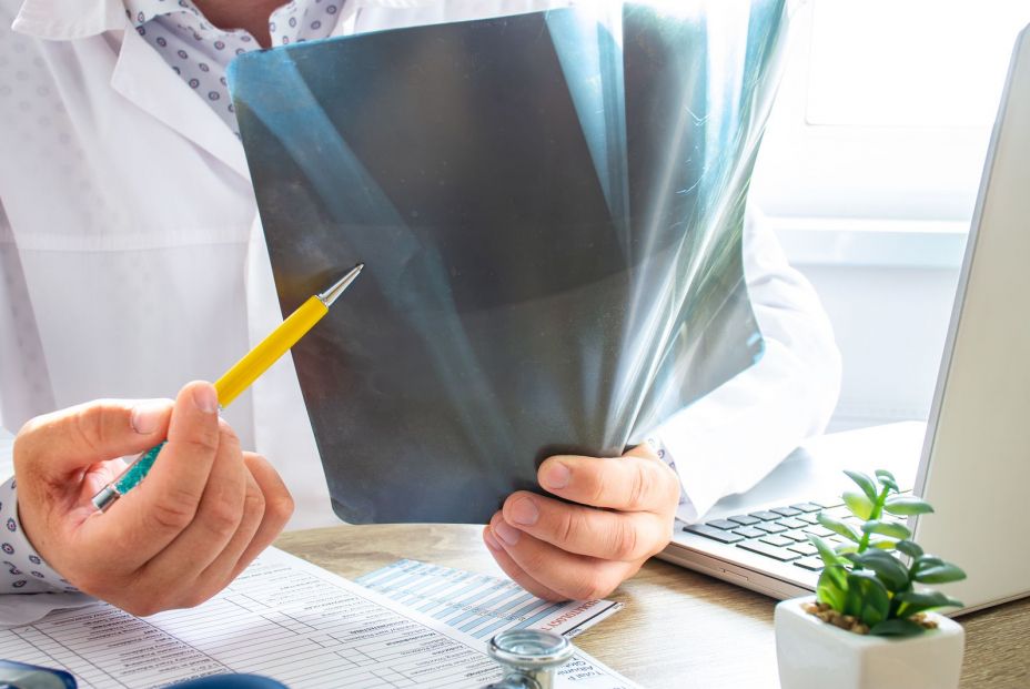 Causas y tratamiento de la osteoporosis Causas y tratamiento de la osteoporosis