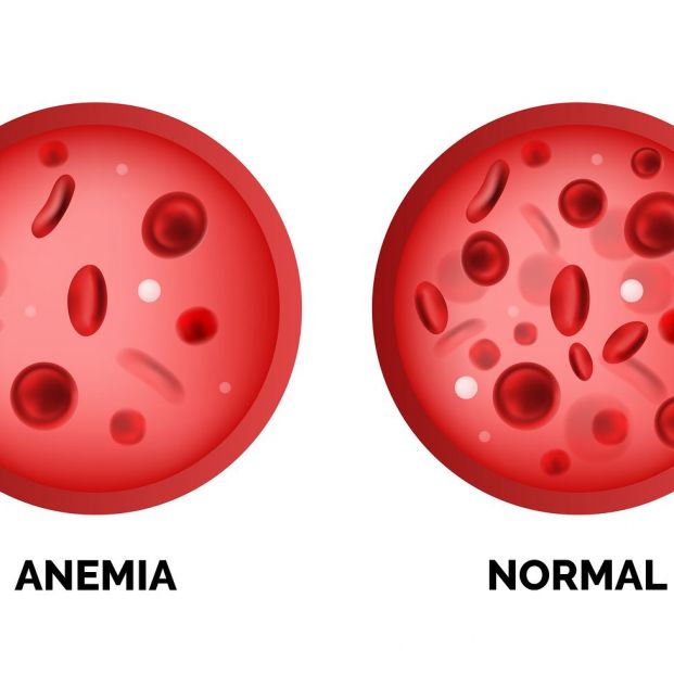 bigstock Infographic Image Of Anemia Is 275558515 bigstock Infographic Image Of Anemia Is 275558515