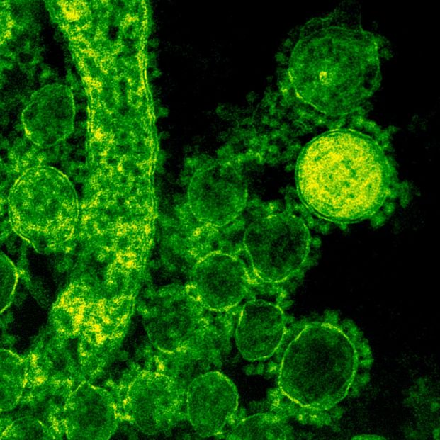 UN EQUIPO DEL CSIC BUSCA LA PRODUCCIÓN ULTRARRÁPIDA DE ANTICUERPOS NEUTRALIZANTES CONTRA EL CORONAVIRUS - Foto: Europa Press UN EQUIPO DEL CSIC BUSCA LA PRODUCCIÓN ULTRARRÁPIDA DE ANTICUERPOS NEUTRALIZANTES CONTRA EL CORONAVIRUS - Foto: Europa Press
