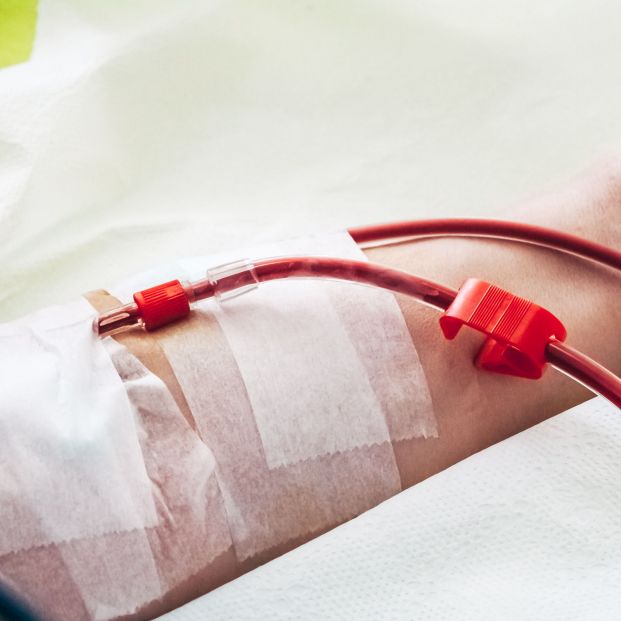 ¿En qué consiste una diálisis?