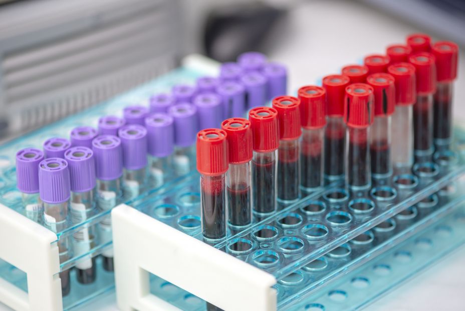 Anticoagulante Anticoagulante