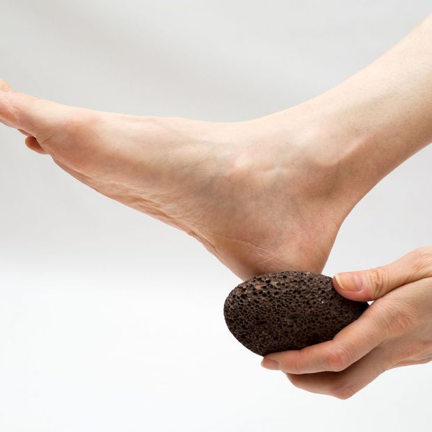 ¿Cómo luchar contra las durezas y callos de los pies? Foto: bigstock ¿Cómo luchar contra las durezas y callos de los pies? Foto: bigstock