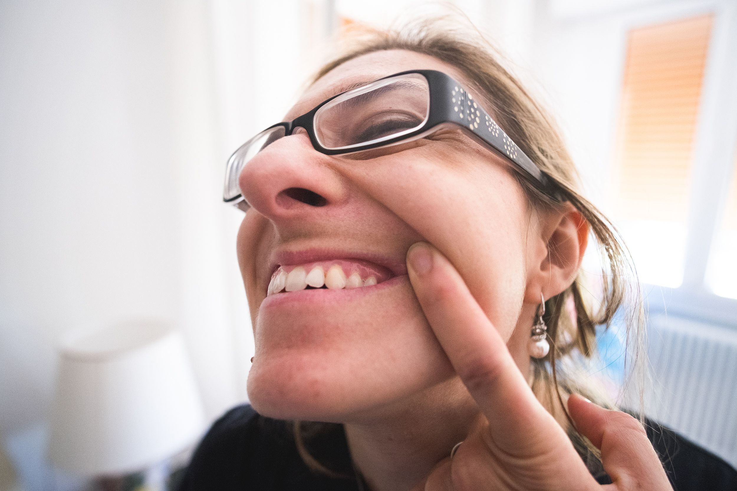 Qué es y cómo se trata la sonrisa gingival