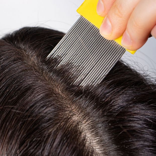 Eucalipto y vinagre: dos remedios infalibles para acabar con los piojos