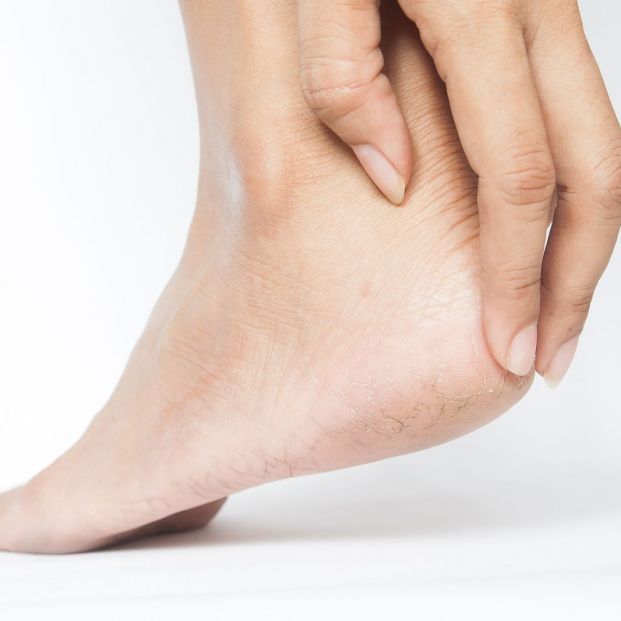 Cómo evitar las rozaduras de los zapatos nuevos Cómo evitar las rozaduras de los zapatos nuevos