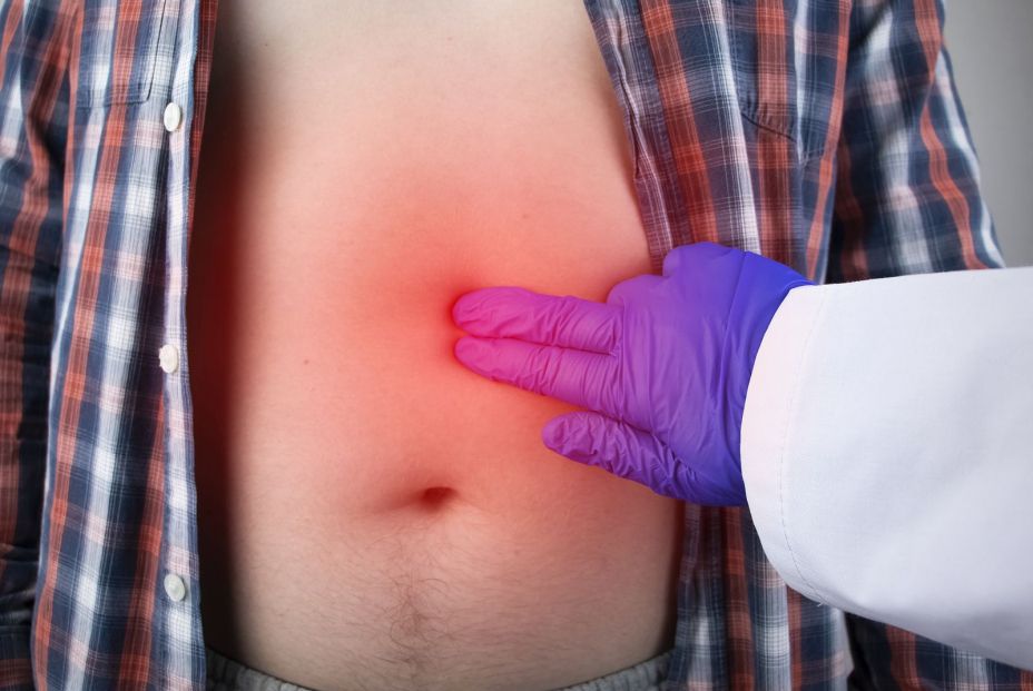 Síntomas que pueden indicar que se sufre una úlcera de estómago Síntomas que pueden indicar que se sufre una úlcera de estómago