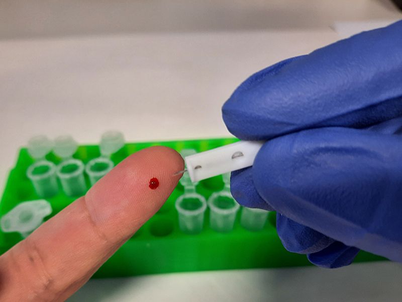 El CSIC desarrolla un test de anticuerpos del coronavirus ultrasensible y fiable al 99% El CSIC desarrolla un test de anticuerpos del coronavirus ultrasensible y fiable al 99%