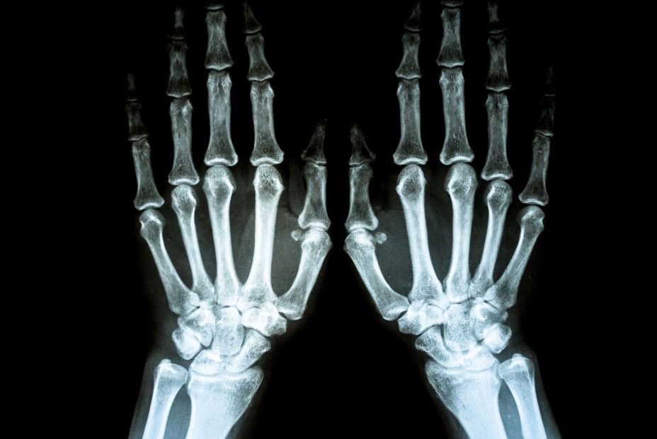 ¿Por qué me duelen las manos? (Bigstock) ¿Por qué me duelen las manos? (Bigstock)