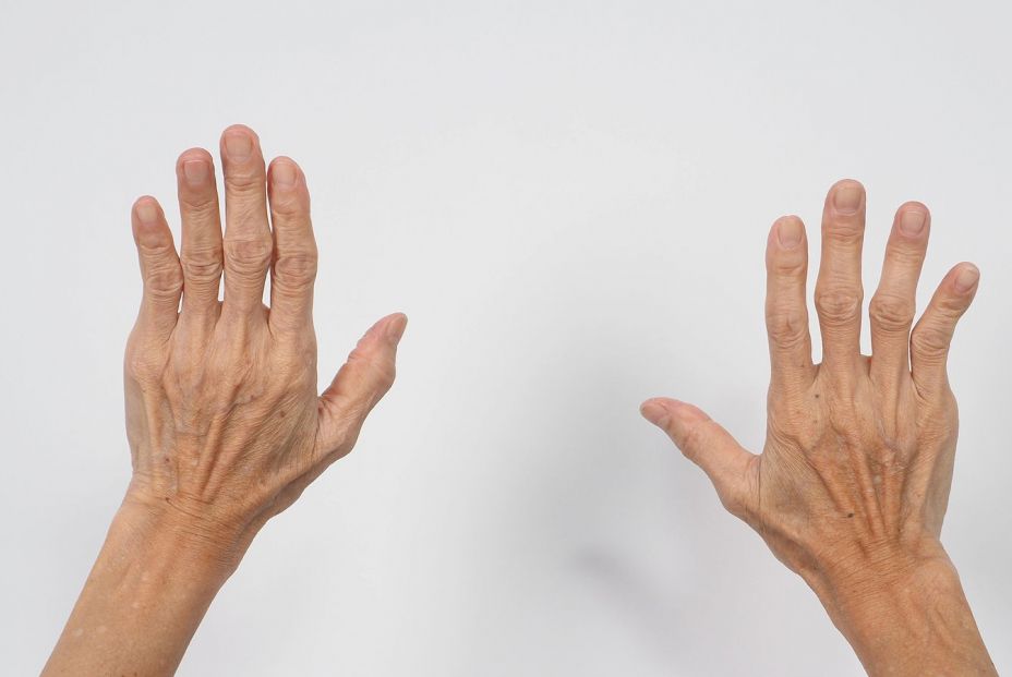 ¿Por qué me duelen las manos? (Bigstock) ¿Por qué me duelen las manos? (Bigstock)