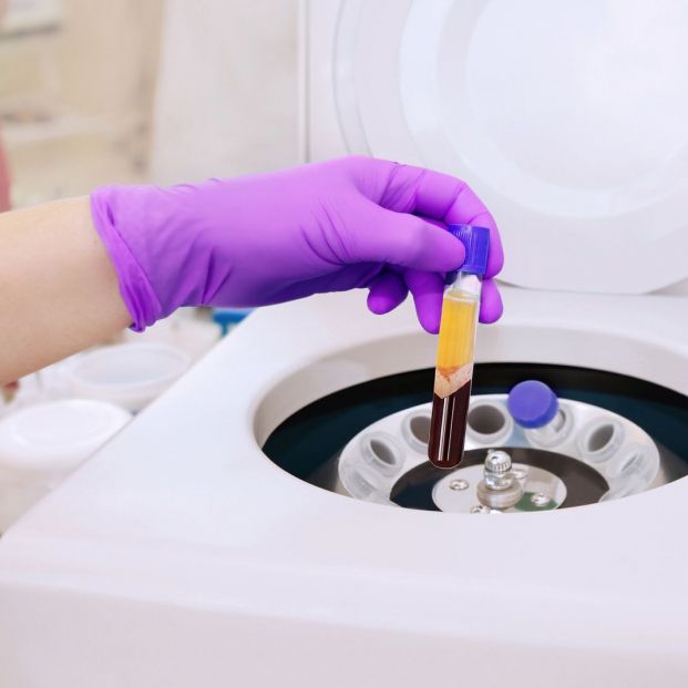 PRP para la caída del cabello: todo lo que debes saber Foto: bigstock PRP para la caída del cabello: todo lo que debes saber Foto: bigstock