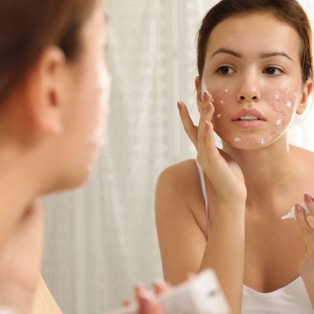 5 aceites naturales para tratar la rosácea Foto: bigstock 5 aceites naturales para tratar la rosácea Foto: bigstock