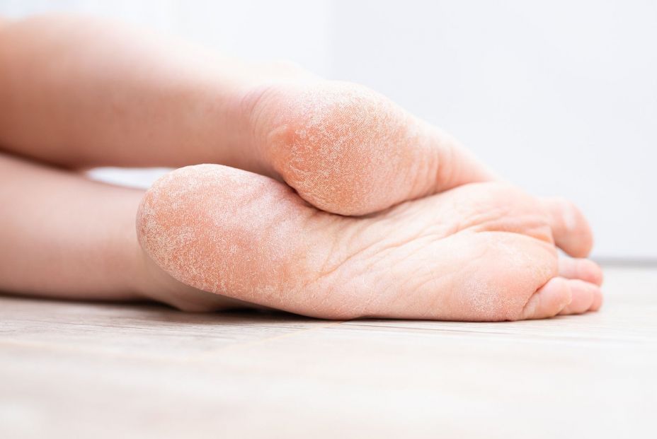 5 pasos para realizar una hidratación profunda de los pies 5 pasos para realizar una hidratación profunda de los pies
