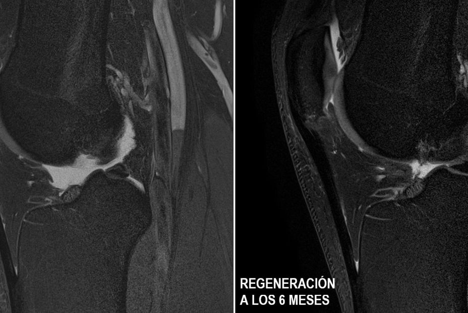 EuropaPress 3719767 instituto terapia regenerativa tisular itrt demostrado ensayo clinico