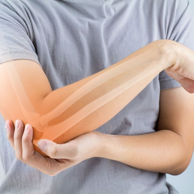 Osteoporosis Osteoporosis