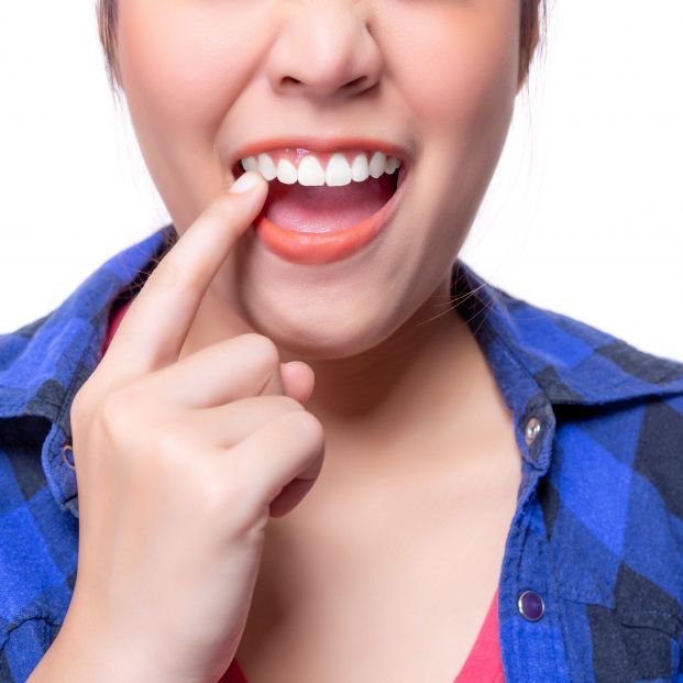 Qué son las fuentes de luz para el blanqueamiento dental y cómo funcionan Qué son las fuentes de luz para el blanqueamiento dental y cómo funcionan