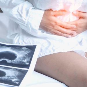 Nuevos descubrimientos en el campo de la endometriosis. Foto: Europa Press Nuevos descubrimientos en el campo de la endometriosis. Foto: Europa Press