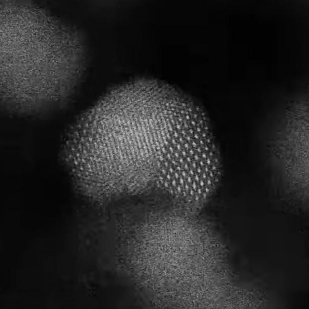  Investigadores del CSIC estudian la aplicación de nanopartículas contra el cáncer de páncreas. Foto: Europa Press