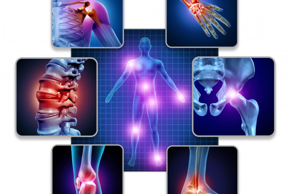 bigstock Human Body Joint Pain Concept314219641