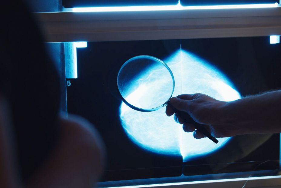 Científicos españoles crean un fármaco que frena la metástasis en el cáncer de mama Científicos españoles crean un fármaco que frena la metástasis en el cáncer de mama