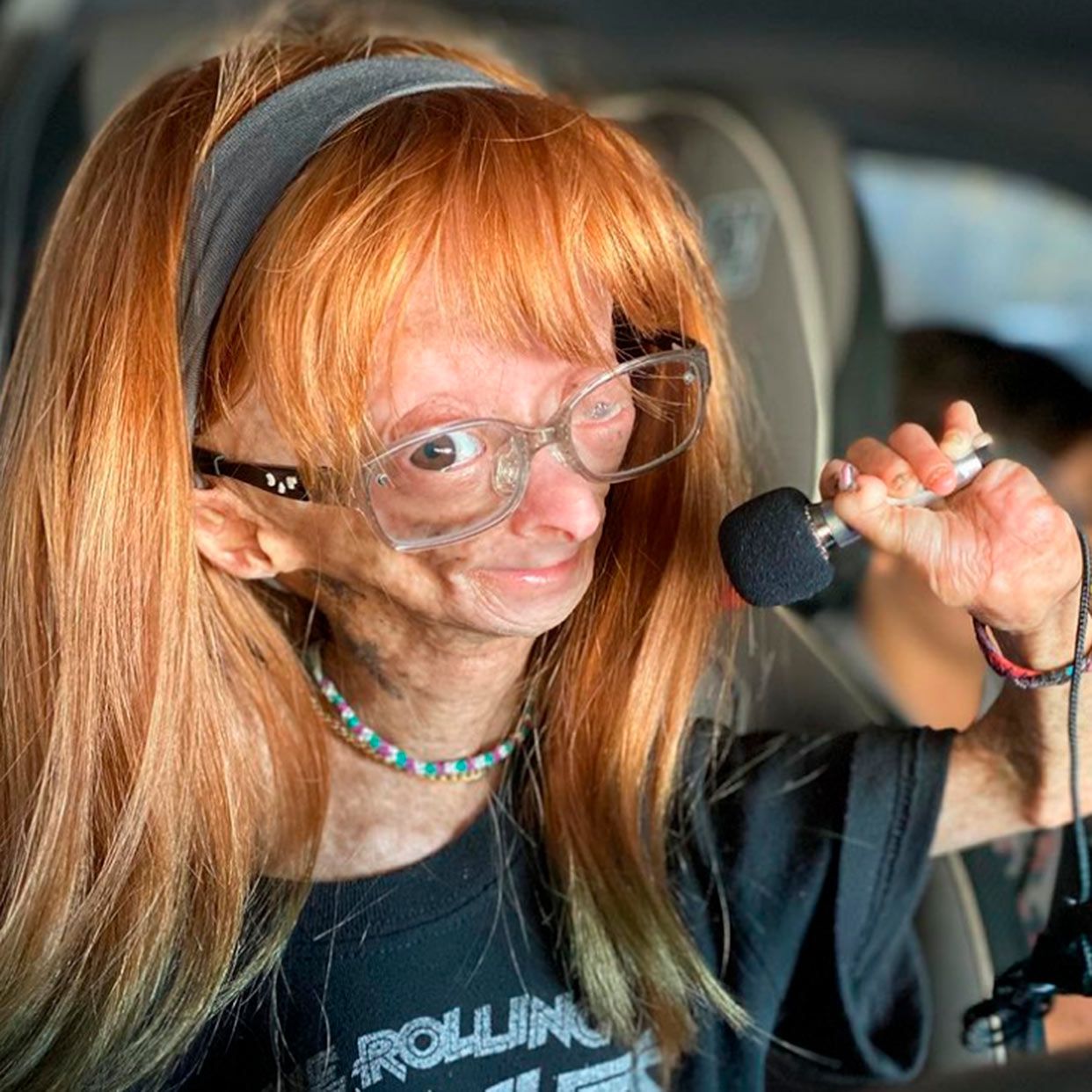 Muere Adalia Rose Williams, la niña que dio visibilidad a la enfermedad del envejecimiento prematuro