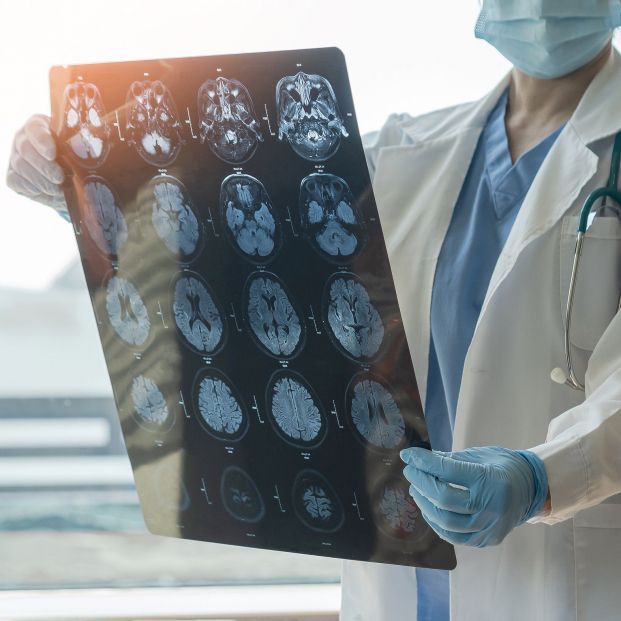 La prevalencia del Alzheimer en España aumentará en 2030, según un estudio. Foto: Bigstock La prevalencia del Alzheimer en España aumentará en 2030, según un estudio. Foto: Bigstock