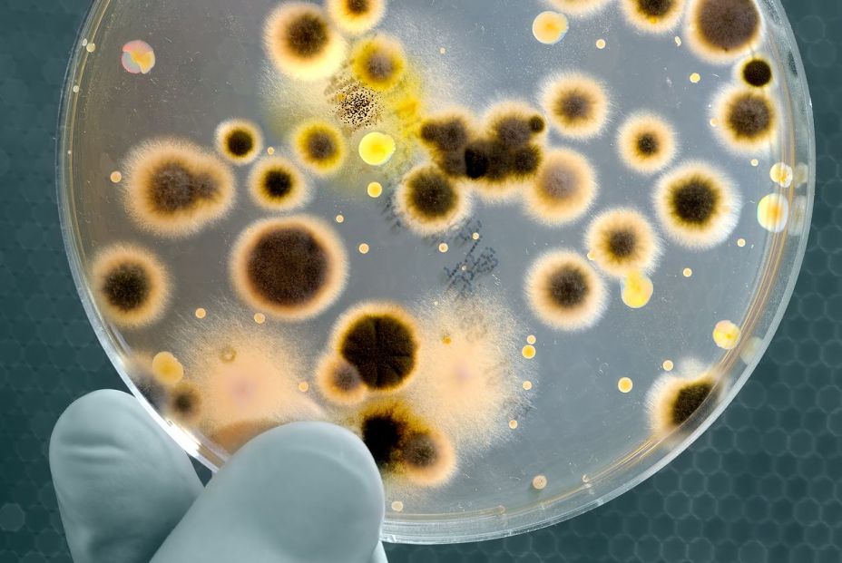 Las bacterias resistentes a los antibióticos ya provocan más muertes que el sida y la malaria Las bacterias resistentes a los antibióticos ya provocan más muertes que el sida y la malaria