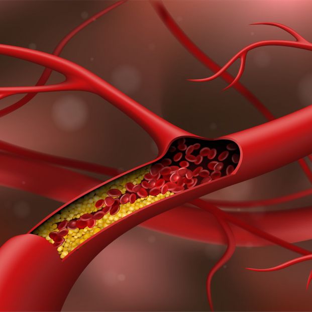 Así debe ser la dieta de una persona con colesterol elevado, según los expertos. Foto: Bigstock Así debe ser la dieta de una persona con colesterol elevado, según los expertos. Foto: Bigstock