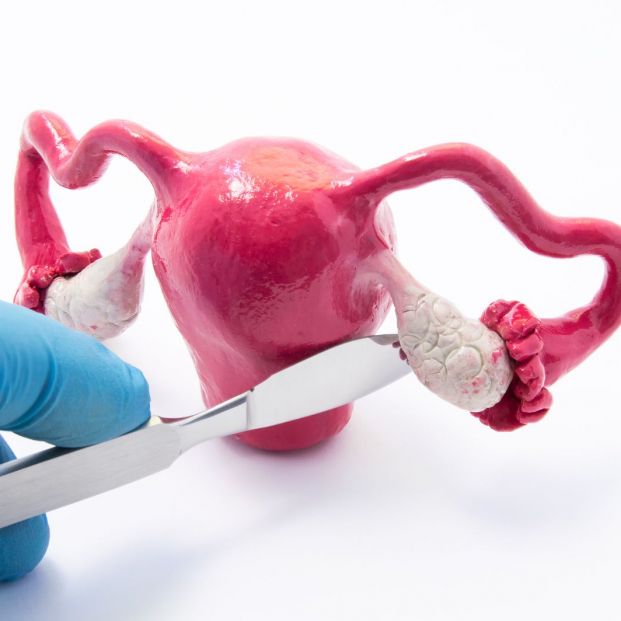 ¿A qué se debe el dolor de ovarios en mujeres cuando estas ya no tienen la menstruación? ¿A qué se debe el dolor de ovarios en mujeres cuando estas ya no tienen la menstruación?